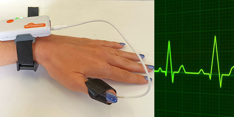 Photoplethysmography (PPG)
